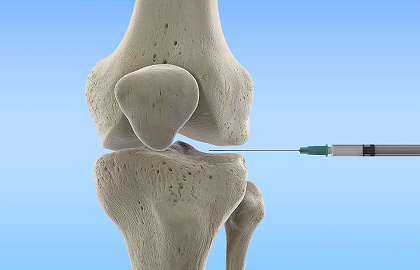 Procedural Radiology